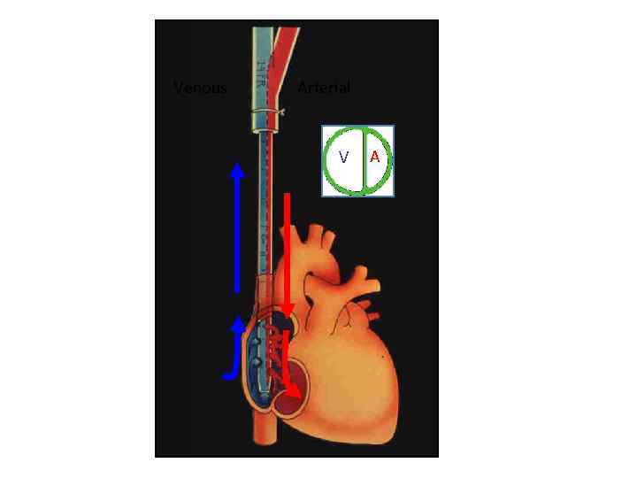 Venous Arterial V A 