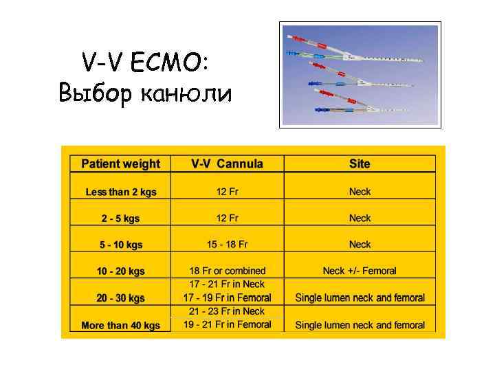 V-V ECMO: Выбор канюли 