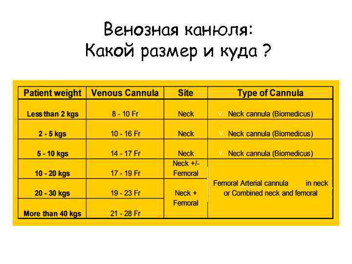 Венозная канюля: Какой размер и куда ? V. V. V. 