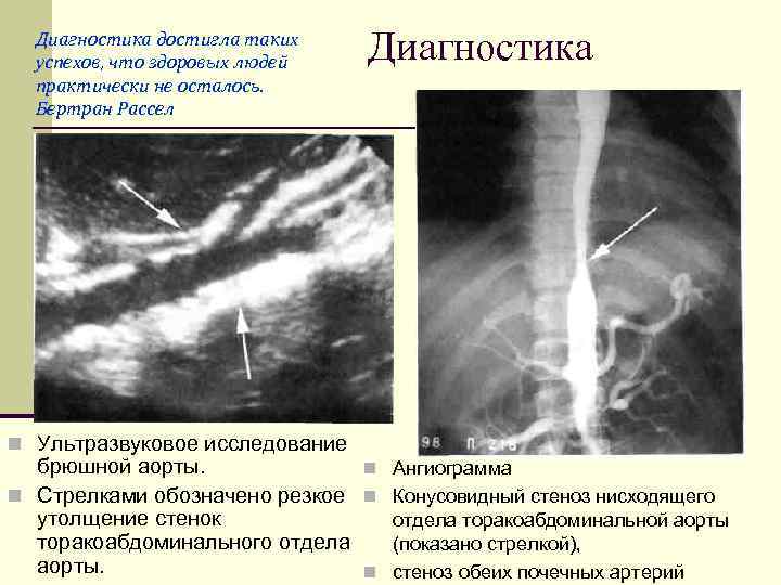 Диагностика достигла таких успехов, что здоровых людей практически не осталось. Бертран Рассел n Ультразвуковое