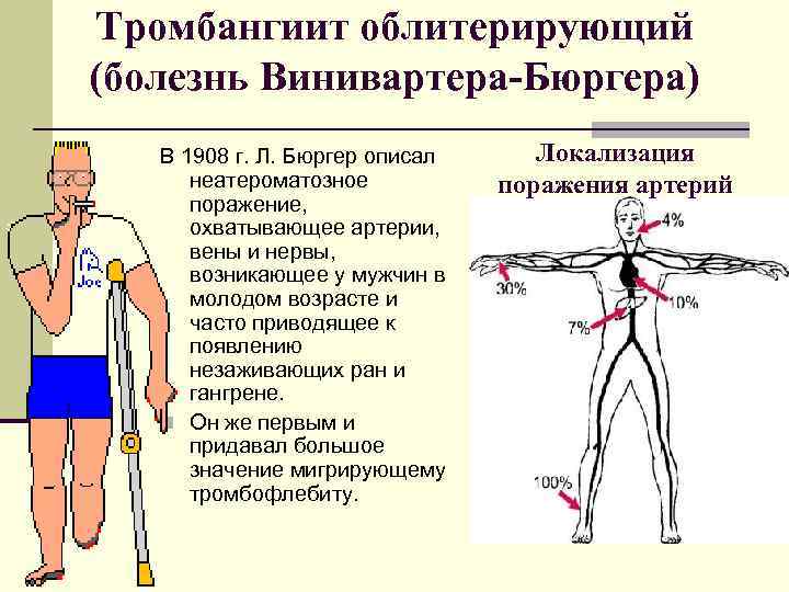 Тромбангиит облитерирующий (болезнь Винивартера-Бюргера) В 1908 г. Л. Бюргер описал неатероматозное поражение, охватывающее артерии,