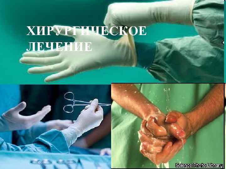 ХИРУРГИЧЕСКОЕ ЛЕЧЕНИЕ 