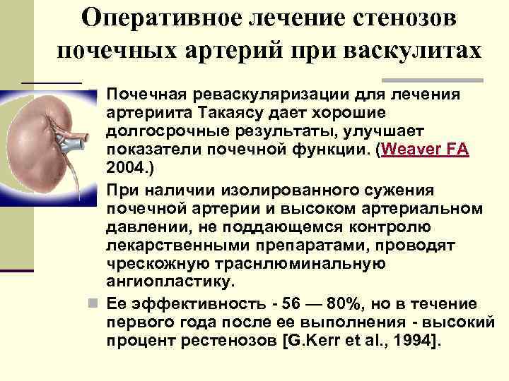 Оперативное лечение стенозов почечных артерий при васкулитах n Почечная реваскуляризации для лечения артериита Такаясу