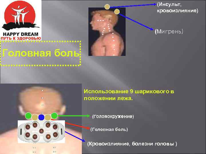 (Инсульт, кровоизлияние) (Мигрень) Головная боль Использование 9 шарикового в положении лежа. (Головокружение) (Головная боль)