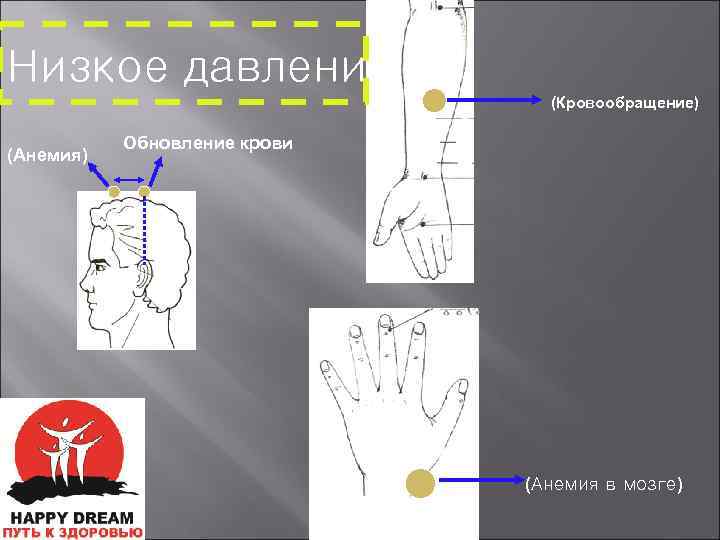 Низкое давление (Кровообращение) (Анемия) Обновление крови (Анемия в мозге) 