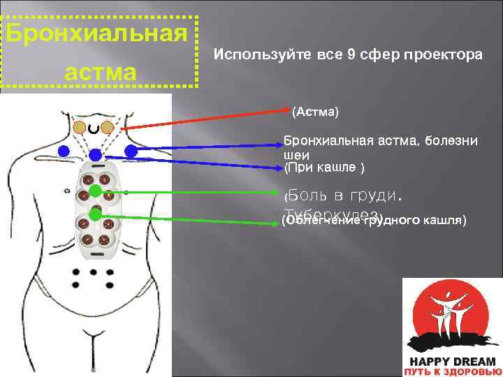 При кашле болит левая. При кашле больно в грудине. Боль в груди посередине при кашле. Точечная боль в грудине.