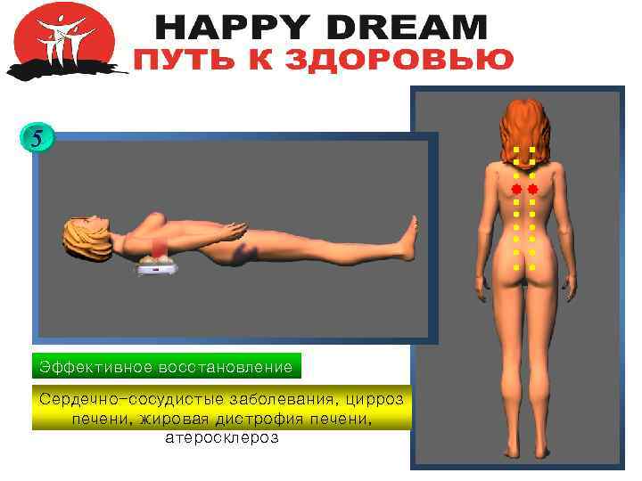5 Эффективное восстановление Сердечно-сосудистые заболевания, цирроз печени, жировая дистрофия печени, атеросклероз 