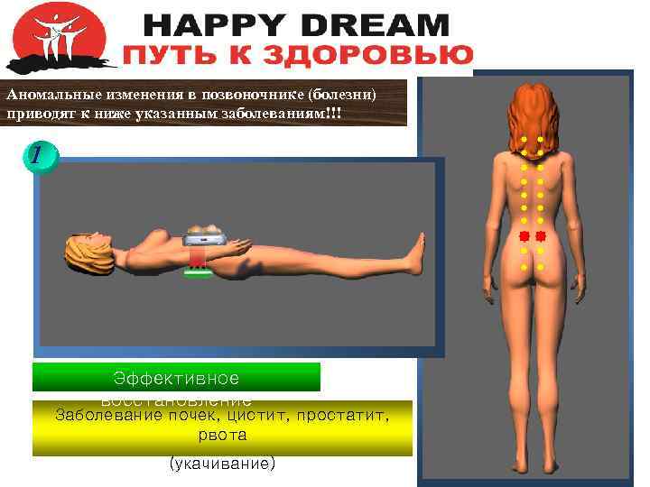 Аномальные изменения в позвоночнике (болезни) приводят к ниже указанным заболеваниям!!! 1 Эффективное восстановление Заболевание