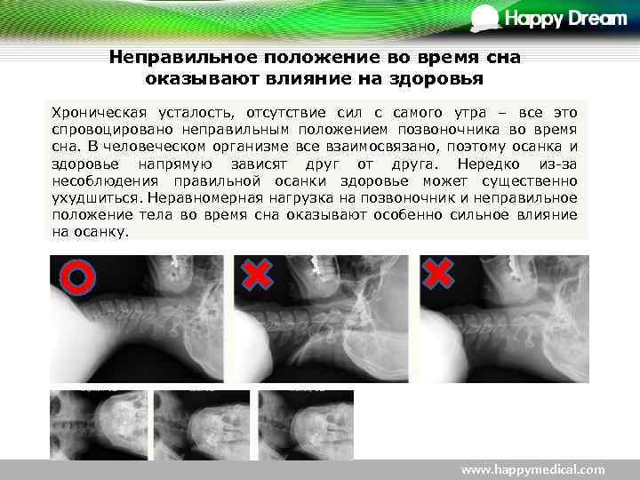 Неправильное положение во время сна оказывают влияние на здоровья Хроническая усталость, отсутствие сил с