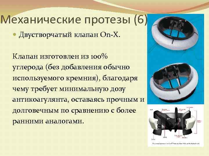 Механические протезы (6) Двустворчатый клапан On-X. Клапан изготовлен из 100% углерода (без добавления обычно