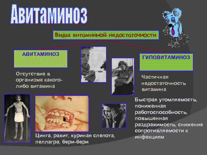 Виды витаминной недостаточности АВИТАМИНОЗ Отсутствие в организме какоголибо витамина Цинга, рахит, куриная слепота, пеллагра,