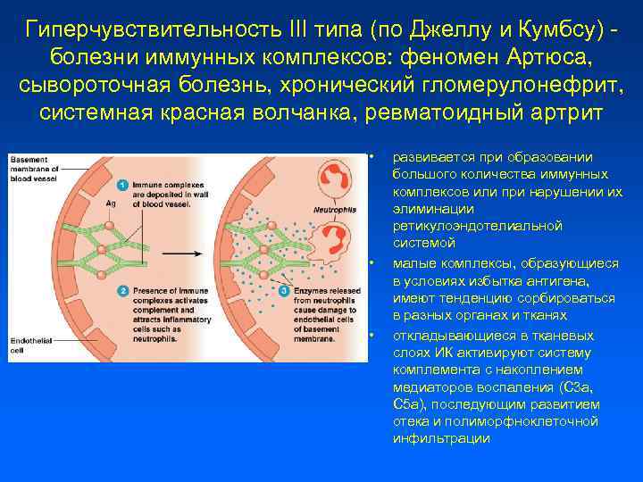 Гиперчувствительность III типа (по Джеллу и Кумбсу) болезни иммунных комплексов: феномен Артюса, сывороточная болезнь,