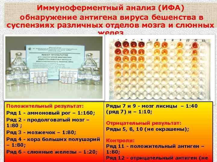 Ифа анализ. ИФА для обнаружения антигенов. Исследование бешенство ИФА. ИФА вирусов. Иммуноферментный анализ обнаружение антигена.