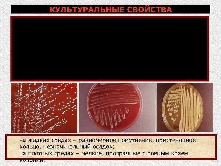 КУЛЬТУРАЛЬНЫЕ СВОЙСТВА Растут на различных питательных средах, лучше на печеночных средах с добавлением глюкозы,