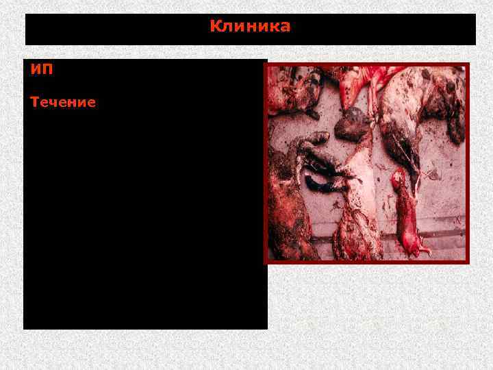 Клиника ИП 2 4 недели и более. Течение в основном, в латентное (у не