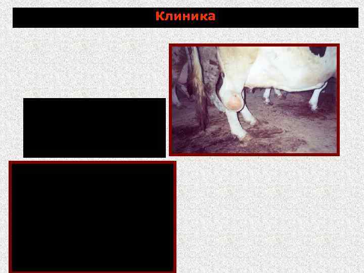 Клиника бурситы, гигромы, артриты, тендовагиниты 