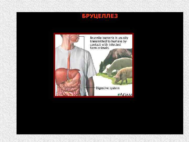 БРУЦЕЛЛЕ 3 (лат. , англ. - Brucellosis; мальтийская лихорадка, болезнь Банга, эпизоотический аборт) Бруцеллез