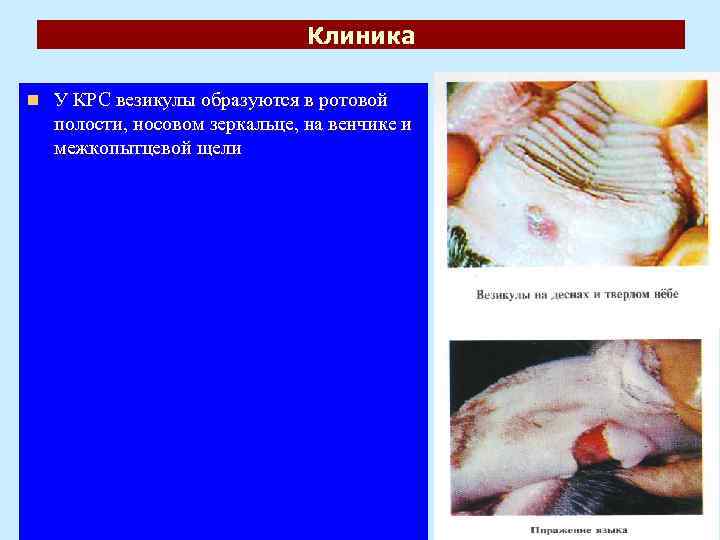 Клиника n У КРС везикулы образуются в ротовой полости, носовом зеркальце, на венчике и