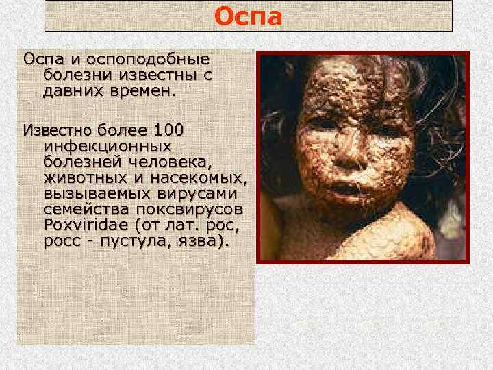 Оспа и оспоподобные болезни известны с давних времен. Известно более 100 инфекционных болезней человека,