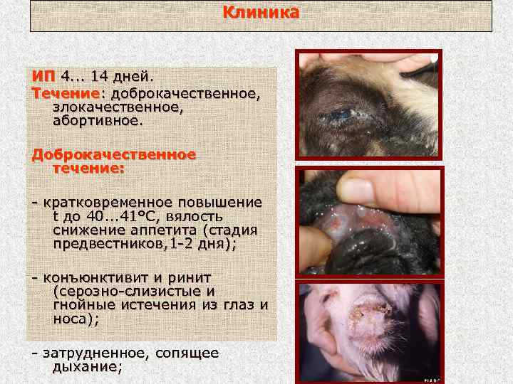 Клиника ИП 4. . . 14 дней. Течение: доброкачественное, злокачественное, абортивное. Доброкачественное течение: -