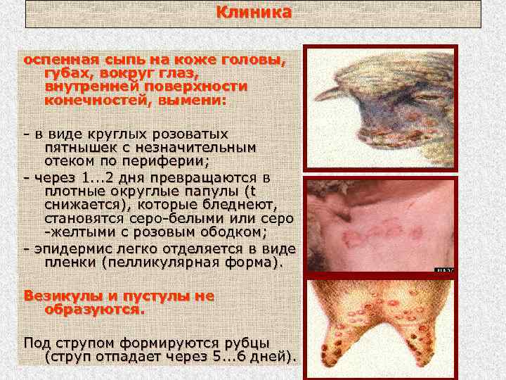 Клиника оспенная сыпь на коже головы, губах, вокруг глаз, внутренней поверхности конечностей, вымени: -