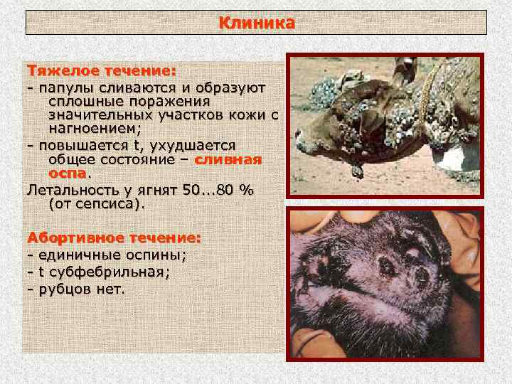 Клиника Тяжелое течение: - папулы сливаются и образуют сплошные поражения значительных участков кожи с