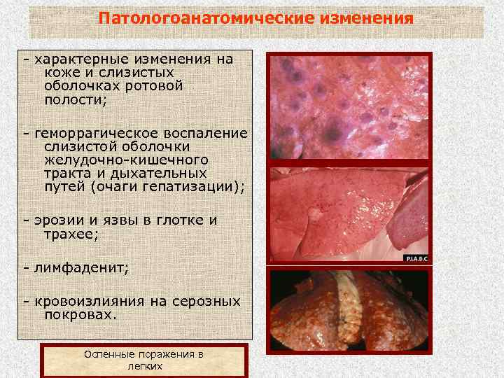Патологоанатомические изменения - характерные изменения на коже и слизистых оболочках ротовой полости; - геморрагическое