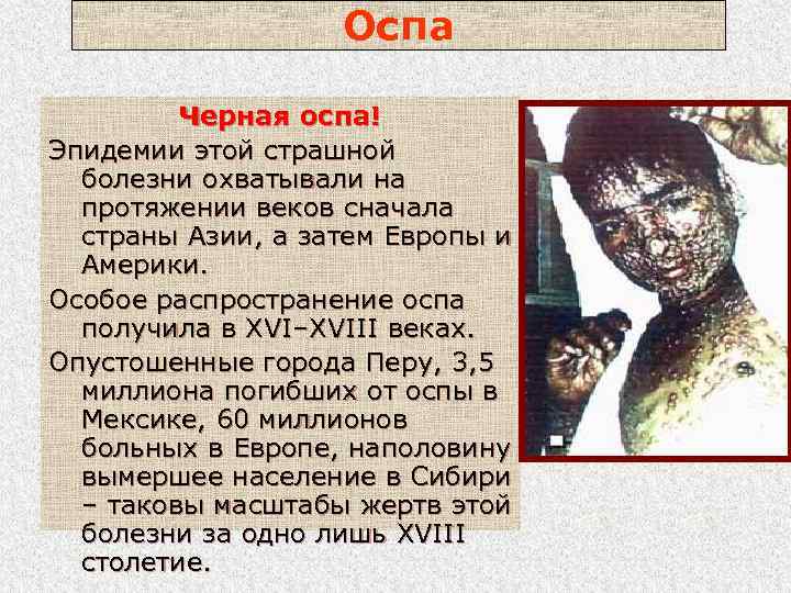 Оспа Черная оспа! Эпидемии этой страшной болезни охватывали на протяжении веков сначала страны Азии,