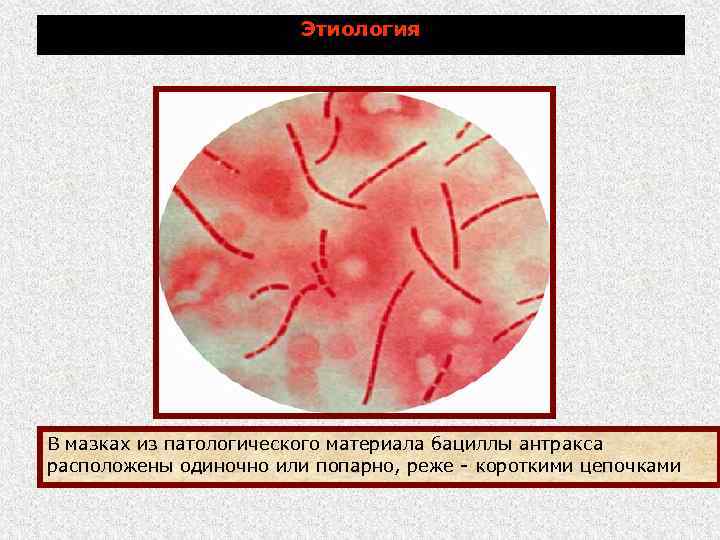 Этиология В мазках из патологического материала бациллы антракса расположены одиночно или попарно, реже короткими