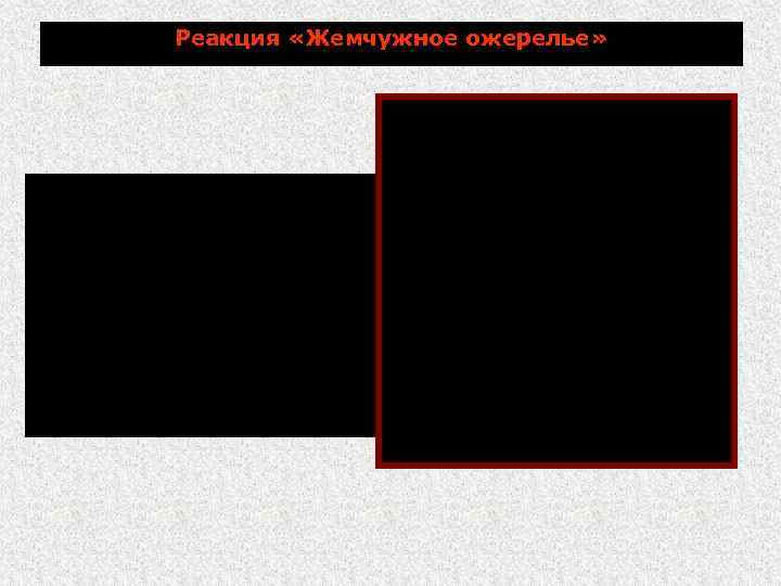 Реакция «Жемчужное ожерелье» Бациллы Сибирской язвы чувствительны к пенициллину in vitro в отличие от