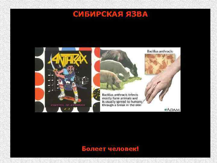 СИБИРСКАЯ ЯЗВА (лат. Febris carbunculosa; англ. – Anthrax; огневик, горящие угли; священный огонь, персидскиий