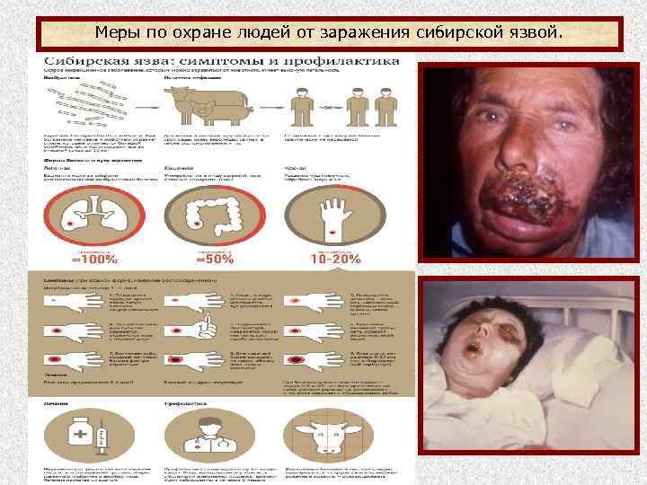 Меры по охране людей от заражения сибирской язвой. 