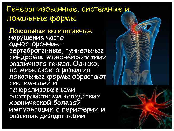 Генерализованные, системные и локальные формы Локальные вегетативные нарушения часто односторонние – вертеброгенные, туннельные синдромы,