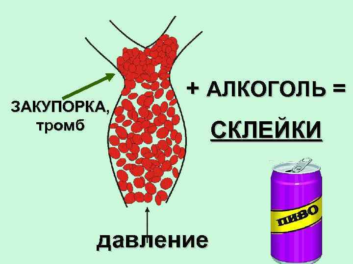 ЗАКУПОРКА, тромб + АЛКОГОЛЬ = давление СКЛЕЙКИ 