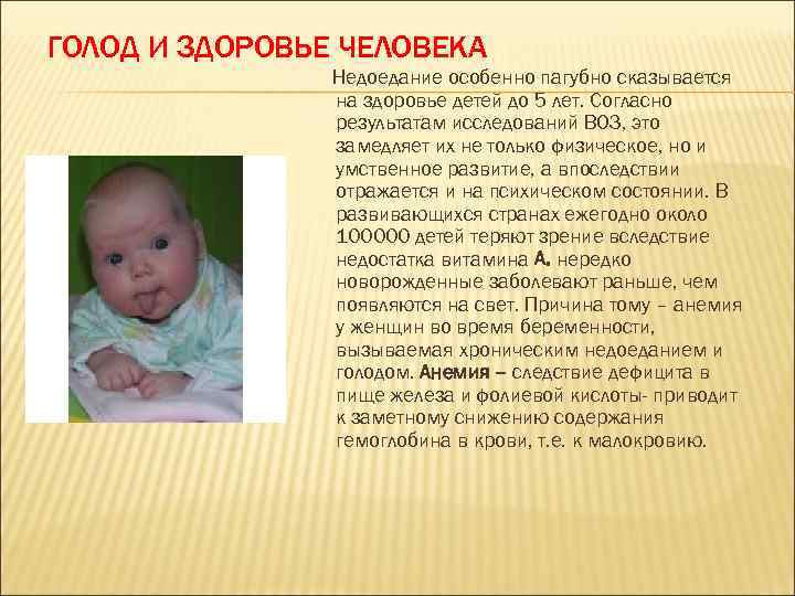 ГОЛОД И ЗДОРОВЬЕ ЧЕЛОВЕКА Недоедание особенно пагубно сказывается на здоровье детей до 5 лет.