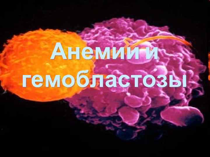 Анемии и гемобластозы 