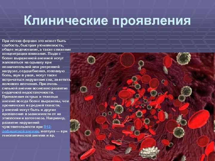Клинические проявления При лёгких формах это может быть слабость, быстрая утомляемость, общее недомогание, а