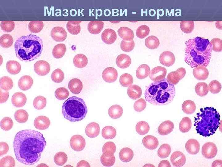 Мазок крови норма 