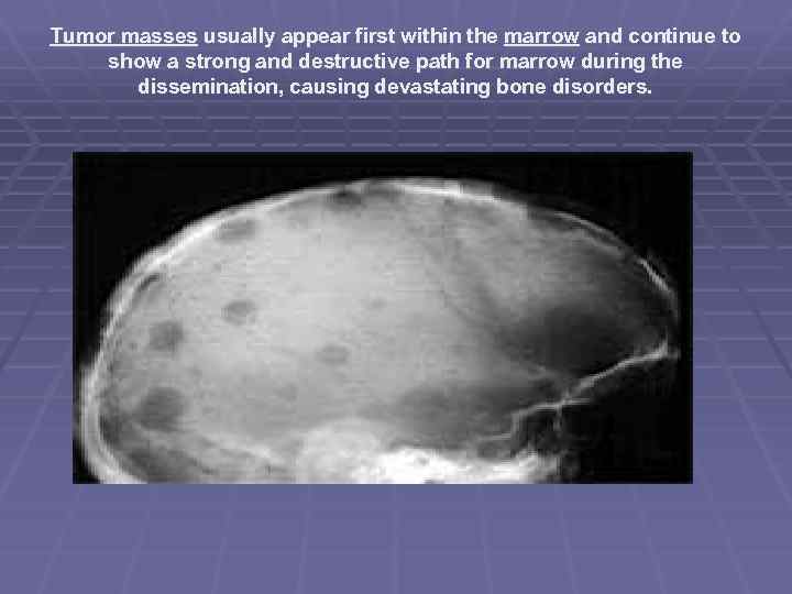 Tumor masses usually appear first within the marrow and continue to show a strong