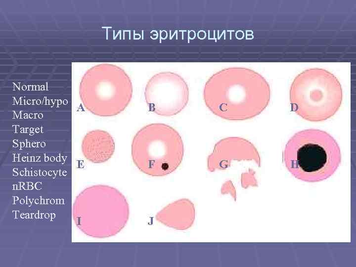 Типы эритроцитов Normal Micro/hypo A Macro Target Sphero Heinz body E Schistocyte n. RBC