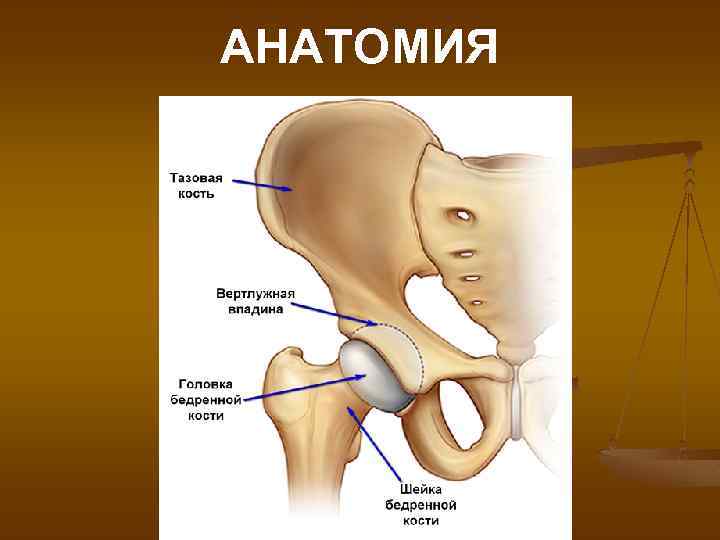 Перелом вертлужной впадины презентация