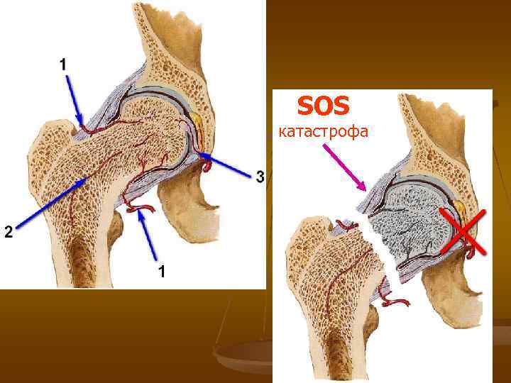 SOS катастрофа 