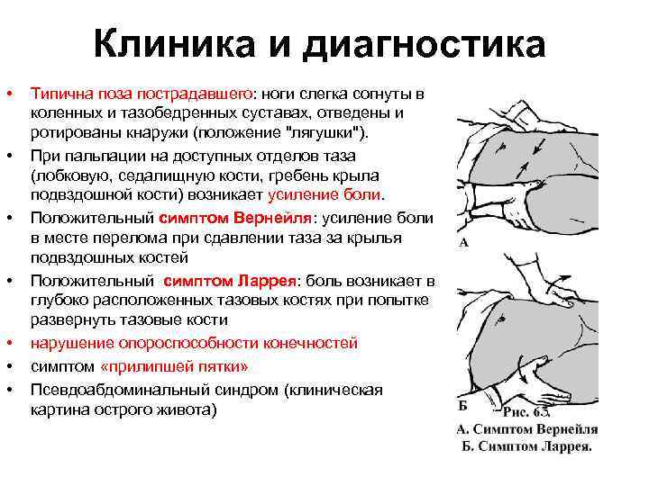 Клиника и диагностика • • Типична поза пострадавшего: ноги слегка согнуты в коленных и