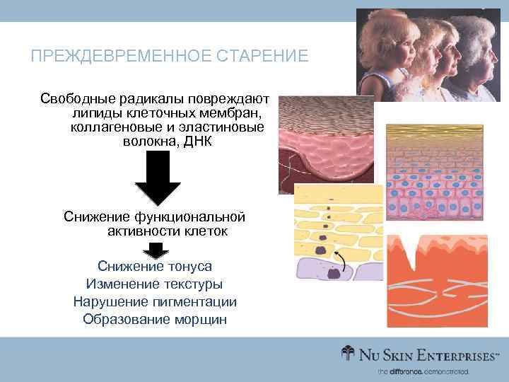 ПРЕЖДЕВРЕМЕННОЕ СТАРЕНИЕ Свободные радикалы повреждают липиды клеточных мембран, коллагеновые и эластиновые волокна, ДНК Снижение