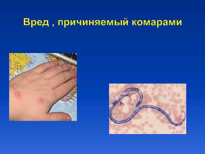 Вред , причиняемый комарами 