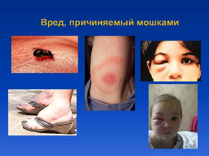 Вред, причиняемый мошками 