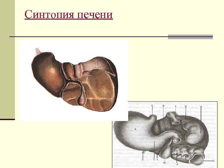 Синтопия нижней поверхности печени схема