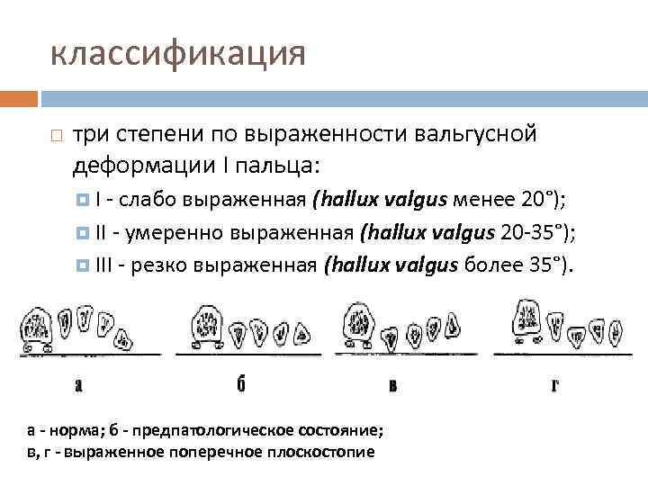 классификация три степени по выраженности вальгусной деформации I пальца: I - слабо выраженная (hallux
