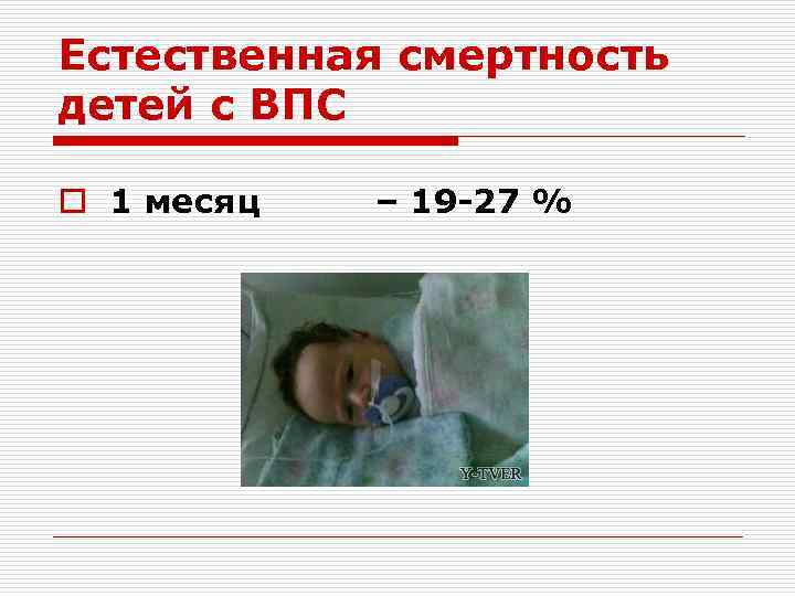 Естественная смертность детей с ВПС o 1 месяц – 19 -27 % 