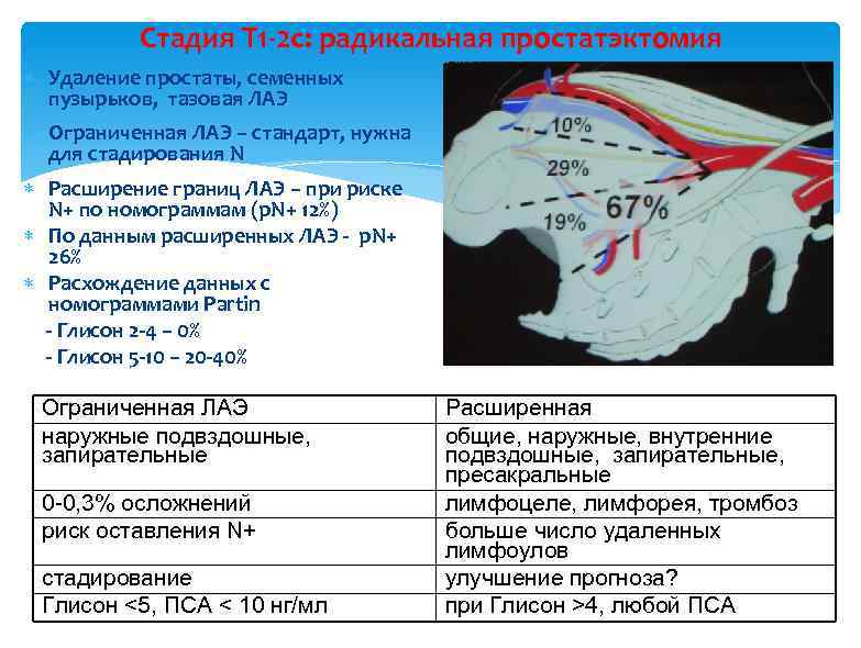 Стадия Т 1 -2 с: радикальная простатэктомия Удаление простаты, семенных пузырьков, тазовая ЛАЭ Ограниченная